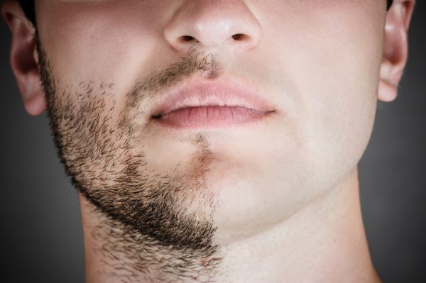 Волосы на лице у мужчин
