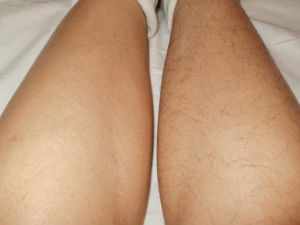 Ноги до и после ваксинга
