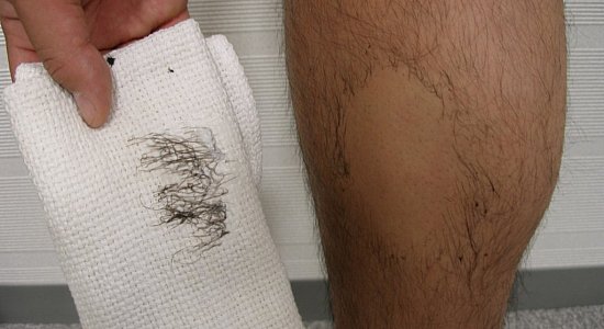 Удаление мужских волос кремом