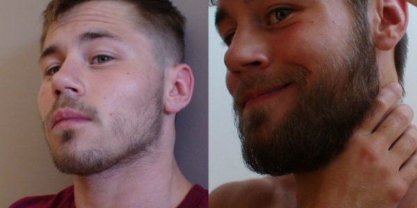 Борода до и после применения касторового масла