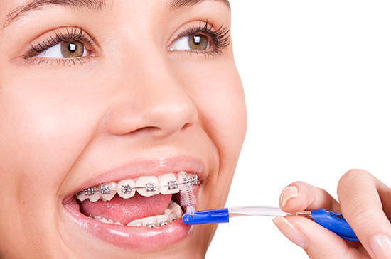 Ёршики для чистки зубов при ортодонтическом лечении