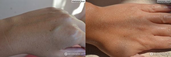 Фото руки до и после применения маски с облепиховым маслом