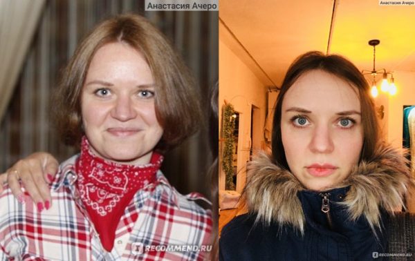 Фото лица до и после использования массажа Асахи