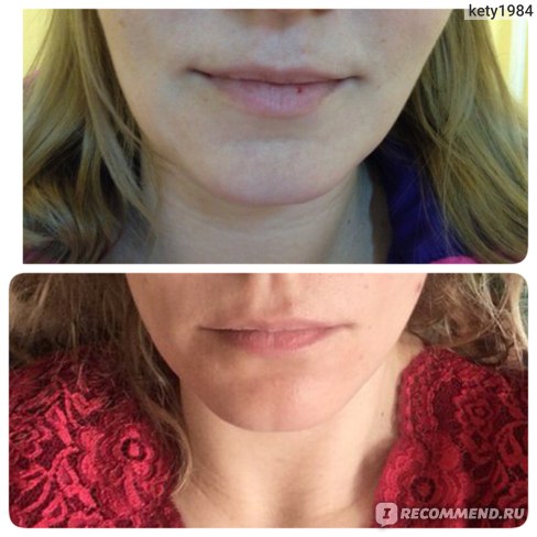 Фото овала лица до и после классического массажа