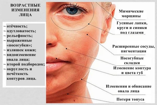 Симптомы возрастных изменений кожи