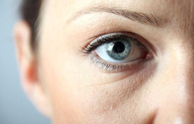 Как избавиться от морщин вокруг глаз: обзор эффективных методик